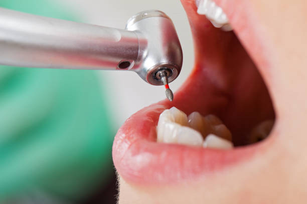 Best Emergency Denture Repair in Leisure Village, NJ